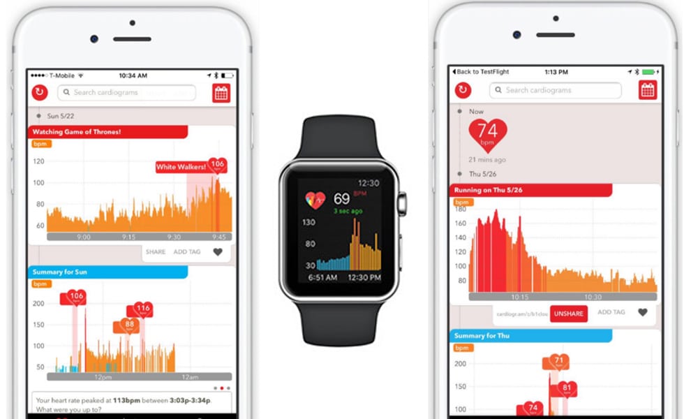 cardiogram-apple-watch