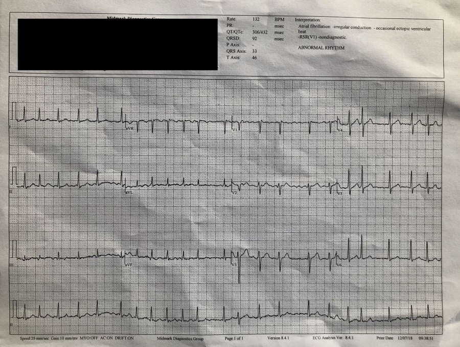 ECG hopital